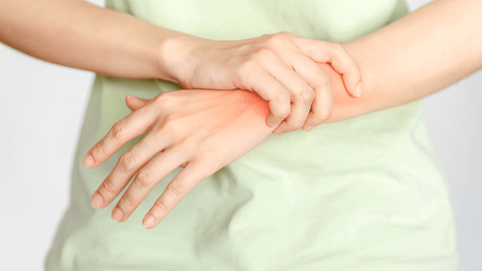 Rheumatoid ArthritisTreatment Options - Velobiotics 